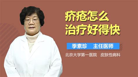 得了疥疮怎么办小妙招有哪些
