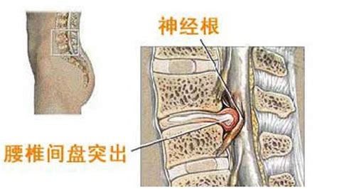 金钟花的附方