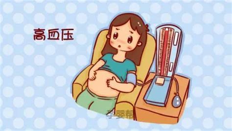 妊娠期高血压综合征的分类