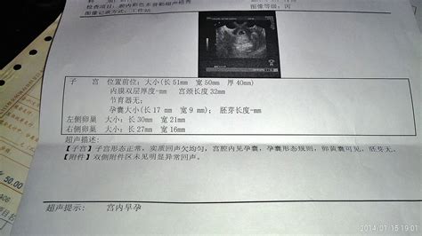 怀孕8周补什么最好