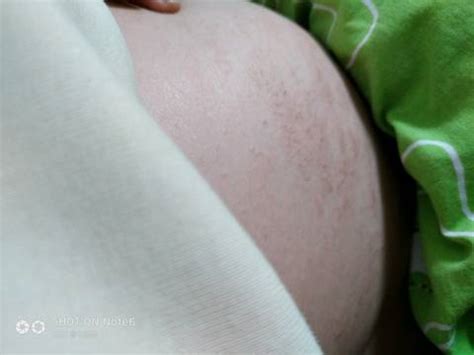 宝宝的肤色和孕期的饮食有关吗