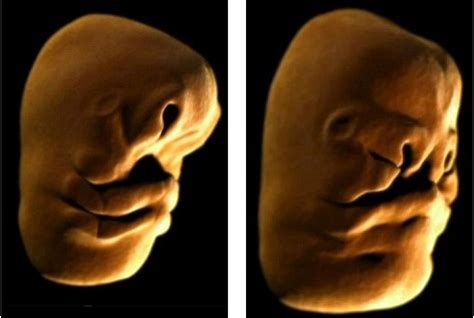 胎儿畸形和什么有关系