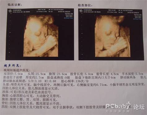 胎教对婴儿的影响有什么
