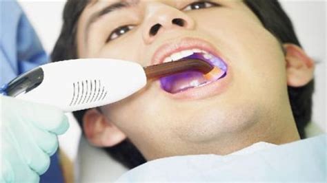 假牙材料有毒有害吗