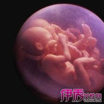 怀孕17周胎儿图片欣赏