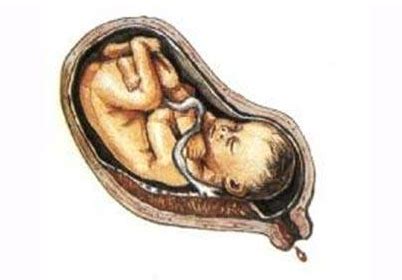 孕中期胎宝宝位置变化