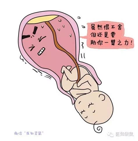 胎儿入盆会有哪些症状